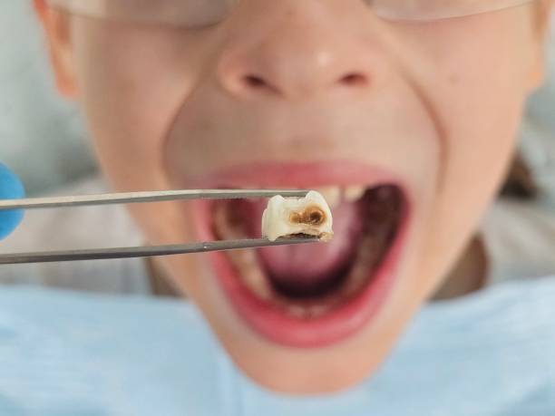 Best Broken Tooth Emergency  in Romancoke, MD